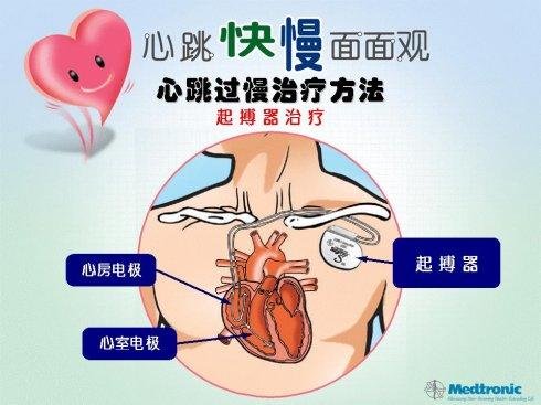 真空吸尘器的使用方法及注意事项